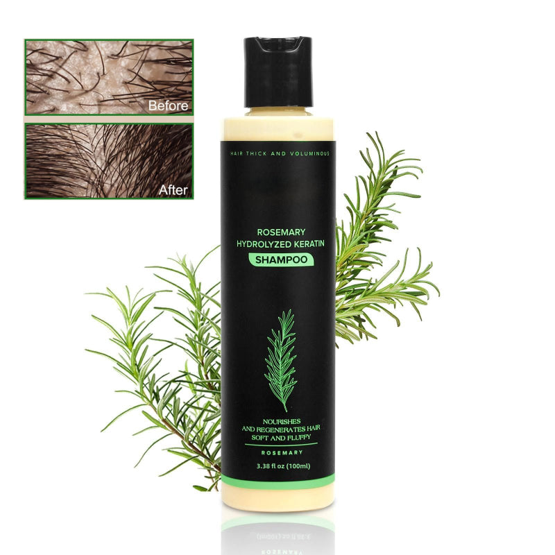 🔖Buy 2 Get 1 Free🧴Tgideas Organic Rosemary Hair Growth Shampoo & Hair Conditioner