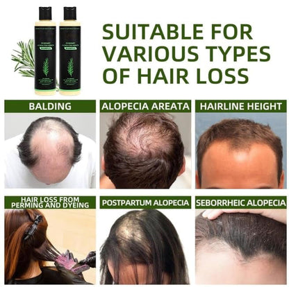 🔖Buy 2 Get 1 Free🧴Tgideas Organic Rosemary Hair Growth Shampoo & Hair Conditioner