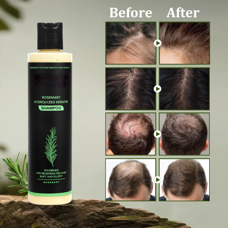 🔖Buy 2 Get 1 Free🧴Tgideas Organic Rosemary Hair Growth Shampoo & Hair Conditioner