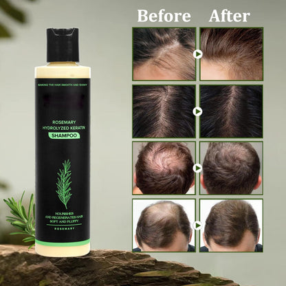 🔖Buy 2 Get 1 Free🧴Tgideas Organic Rosemary Hair Growth Shampoo & Hair Conditioner